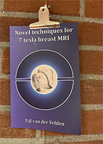 ISBN: 9789039367827 - Title: Novel techniques for 7 tesla breast MRI